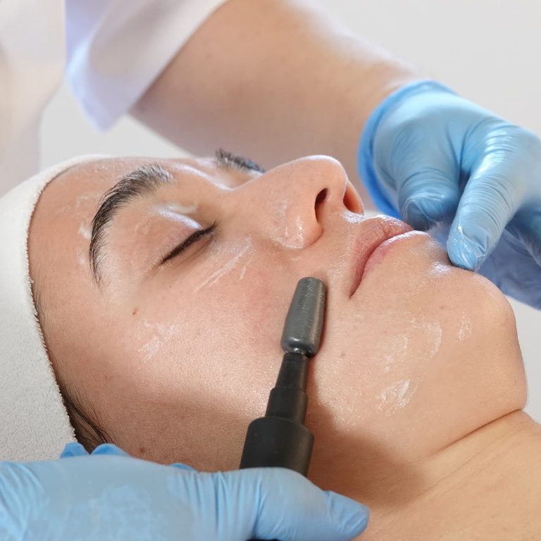 Facial-Rejuvenation-#4 (1)